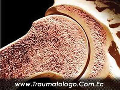 TRAUMATOLOGOS QUITO